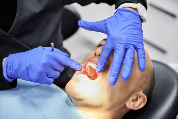 Best Emergency Treatment for Dental Infections or Abscesses in San Clemente, CA